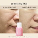 Vinacine Frame mới 2 (1)